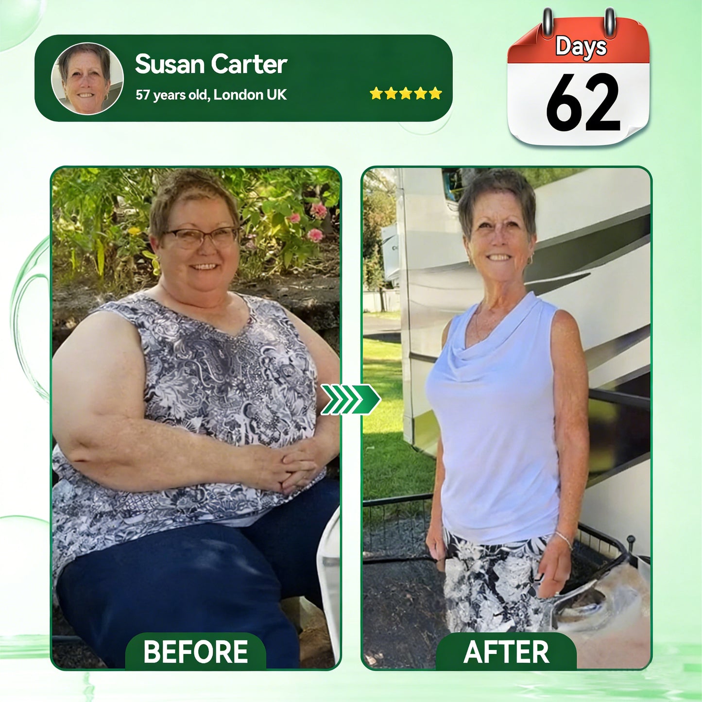 𝑶𝒇𝒇𝒊𝒄𝒊𝒂𝒍 𝑺𝒕𝒐𝒓𝒆 | 𝐂𝐥𝐞𝐫𝐚𝐋𝐮𝐱𝐞® 𝐁𝐫𝐨𝐰𝐧𝐅𝐚𝐭 𝐄𝐱𝐭𝐫𝐚𝐜𝐭 𝐍𝐚𝐧𝐨 𝐌𝐢𝐜𝐫𝐨𝐧𝐞𝐞𝐝𝐥𝐞 𝐏𝐚𝐭𝐜𝐡(𝙅𝙪𝙨𝙩 𝙤𝙣𝙘𝙚 𝙖 𝙙𝙖𝙮, 𝙫𝙞𝙨𝙞𝙗𝙡𝙚 𝙘𝙝𝙖𝙣𝙜𝙚𝙨 𝙞𝙣 7 𝙙𝙖𝙮𝙨)